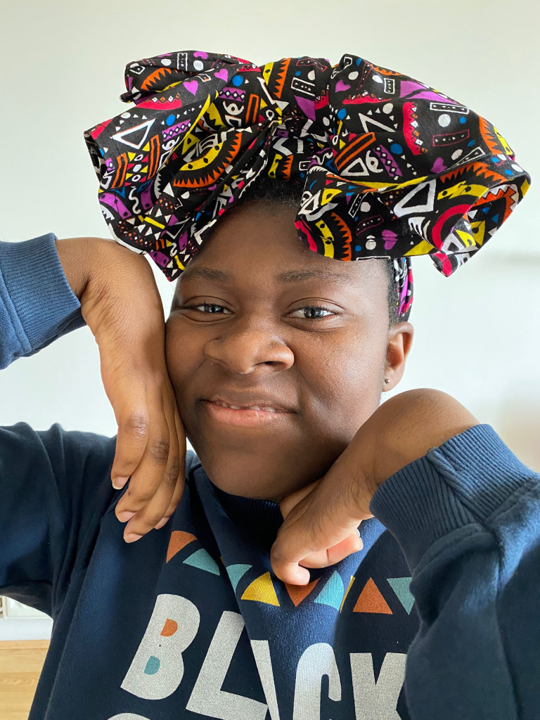 A photo of me smiling with my limp wrists and curled fingers on either side of my face