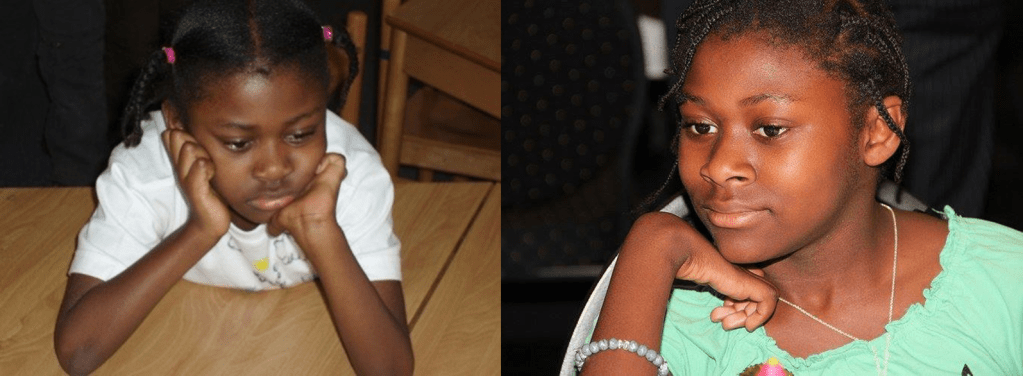 Two pictures. The one on the left is of me as a young child with my chin resting on my hands. You can see that my fingers are curled inwards. The one on the right is of me when I was younger with my chin resting on one hand. My fingers here are also curled.